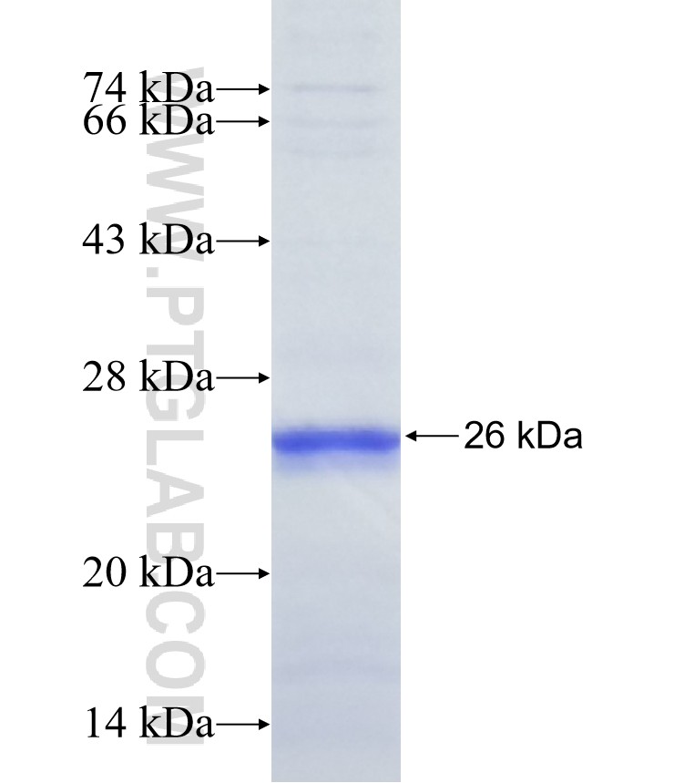 B3GALT5 fusion protein Ag39081 SDS-PAGE B3GALT5 fusion protein Ag39081 SDS-PAGE
