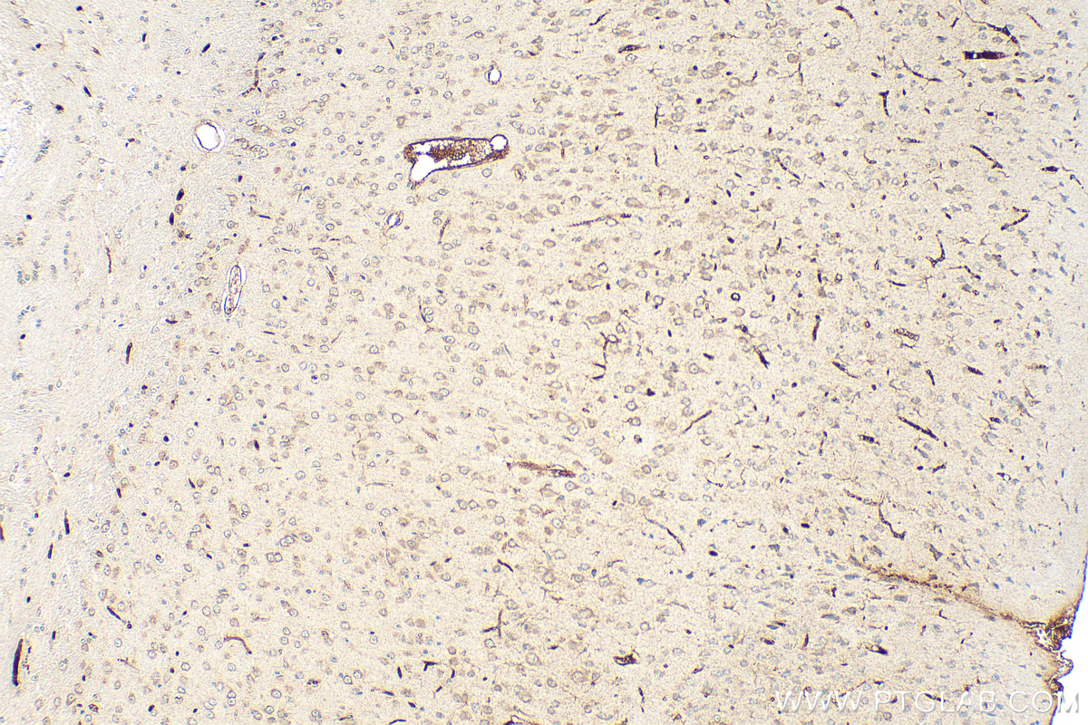 IHC staining of mouse brain using 55049-1-AP