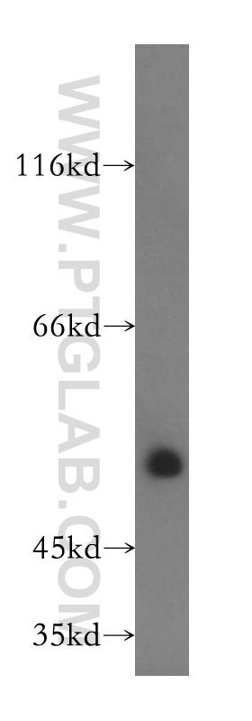 WB analysis of human heart using 14601-1-AP