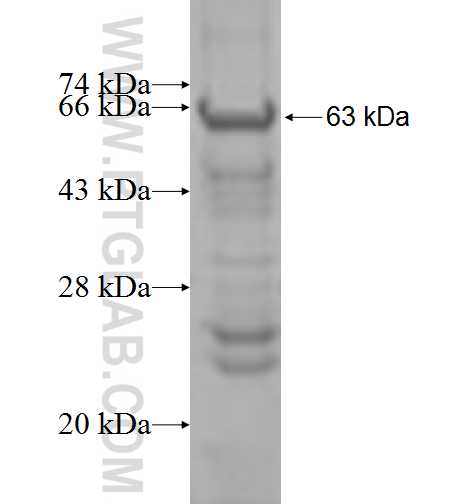 B3GAT3 fusion protein Ag9296 SDS-PAGE B3GAT3 fusion protein Ag9296 SDS-PAGE