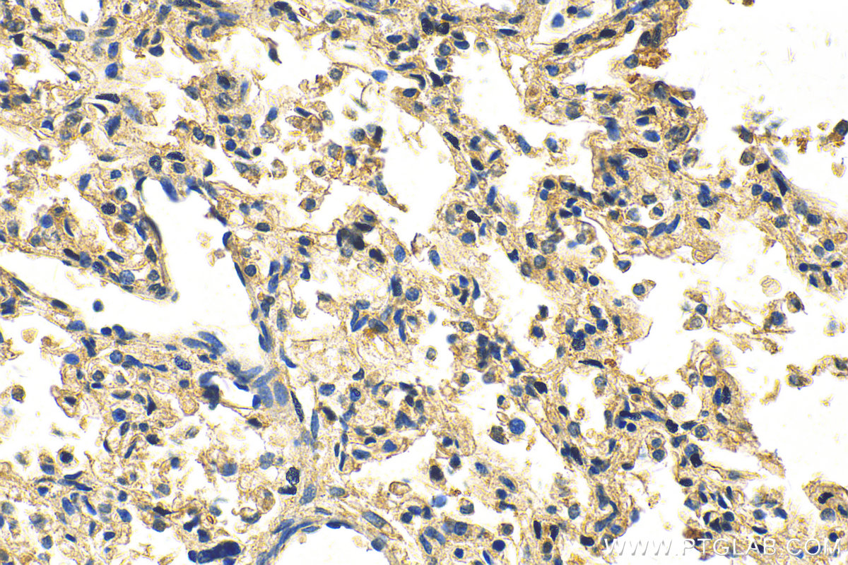 IHC staining of human lung using 20422-1-AP