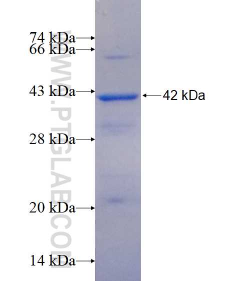B3GNT5 fusion protein Ag14721 SDS-PAGE B3GNT5 fusion protein Ag14721 SDS-PAGE