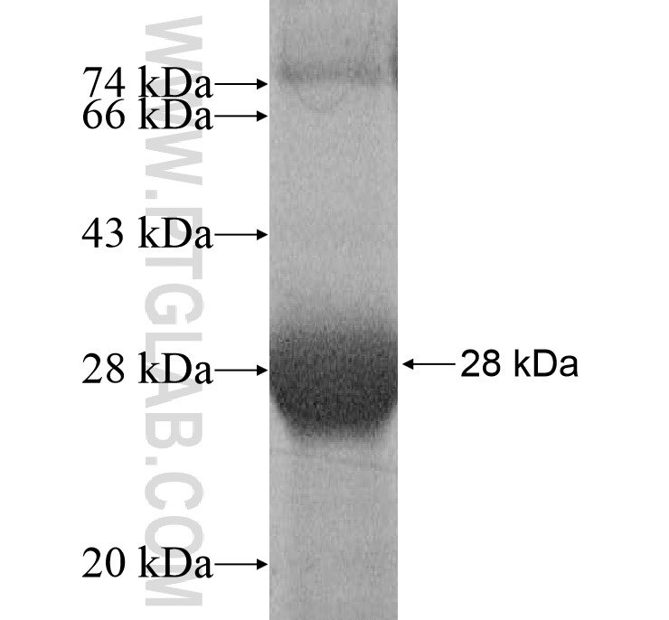 B3GNT6 fusion protein Ag17229 SDS-PAGE