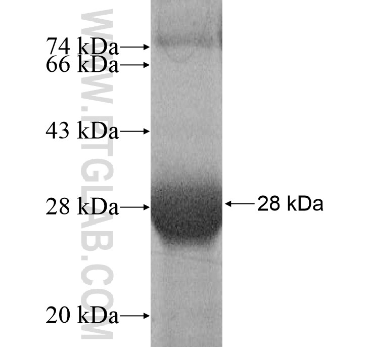 B3GNT6 fusion protein Ag17229 SDS-PAGE B3GNT6 fusion protein Ag17229 SDS-PAGE