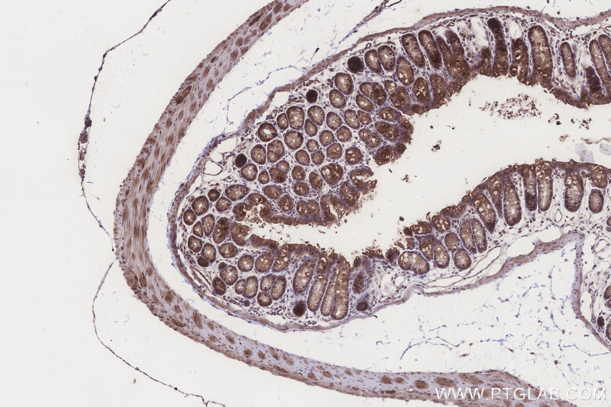 IHC staining of mouse colon using 22879-1-AP IHC staining of mouse colon using 22879-1-AP