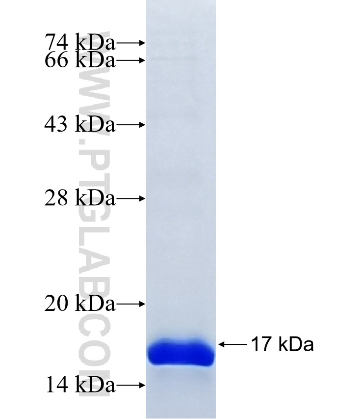 B3GNT8 fusion protein Ag41122 SDS-PAGE B3GNT8 fusion protein Ag41122 SDS-PAGE