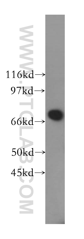 WB analysis of COLO 320 using 13396-1-AP