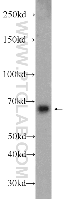 WB analysis of Jurkat using 24024-1-AP
