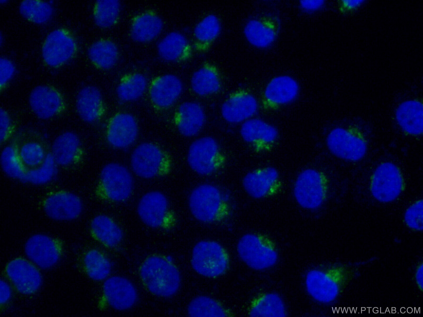 IF Staining of A431 using 11041-1-AP