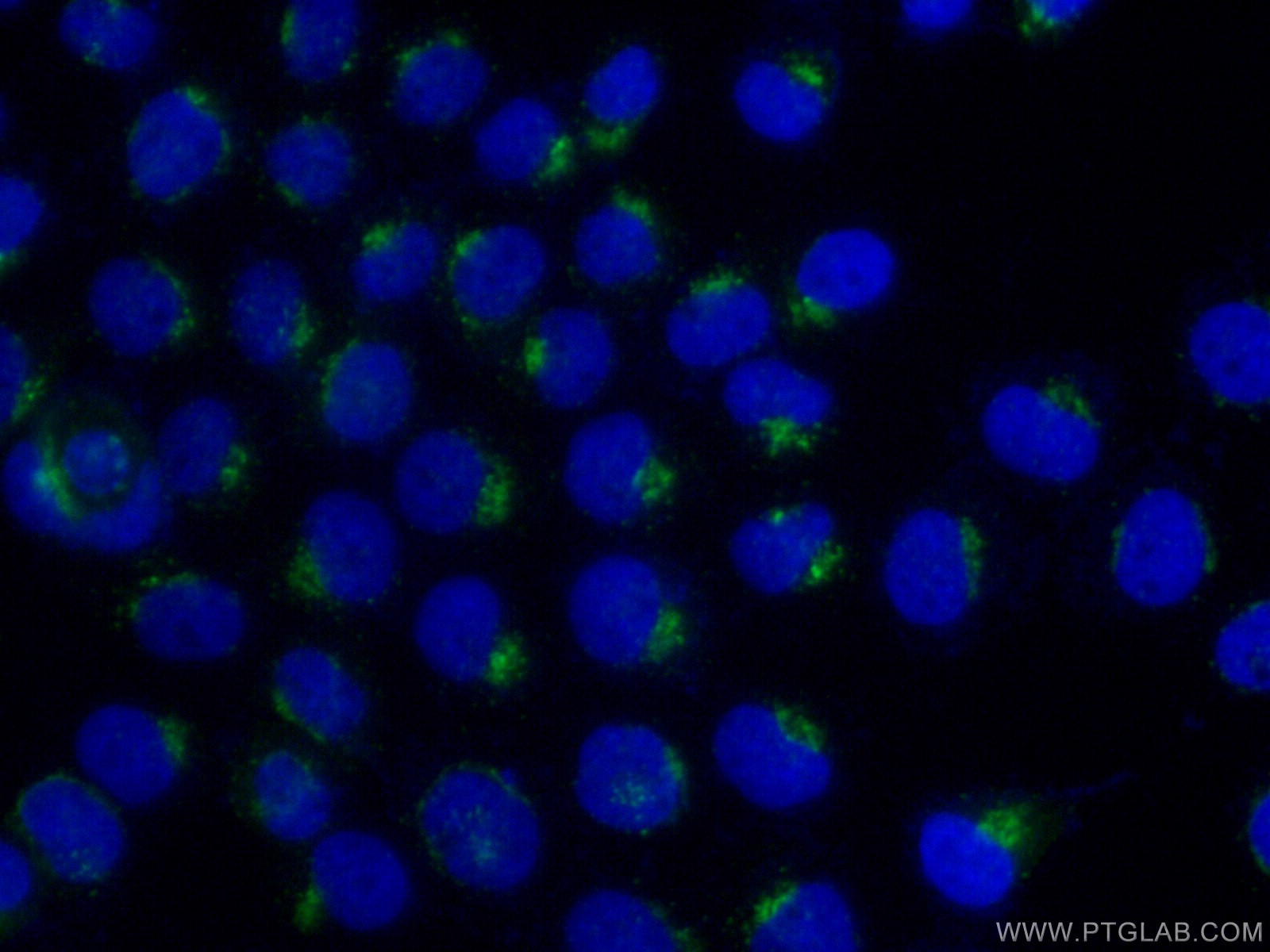 IF Staining of A431 using 11041-1-AP