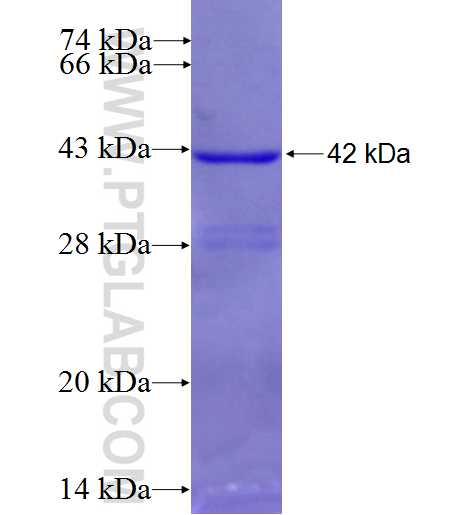 B4GALT4 fusion protein Ag7517 SDS-PAGE B4GALT4 fusion protein Ag7517 SDS-PAGE