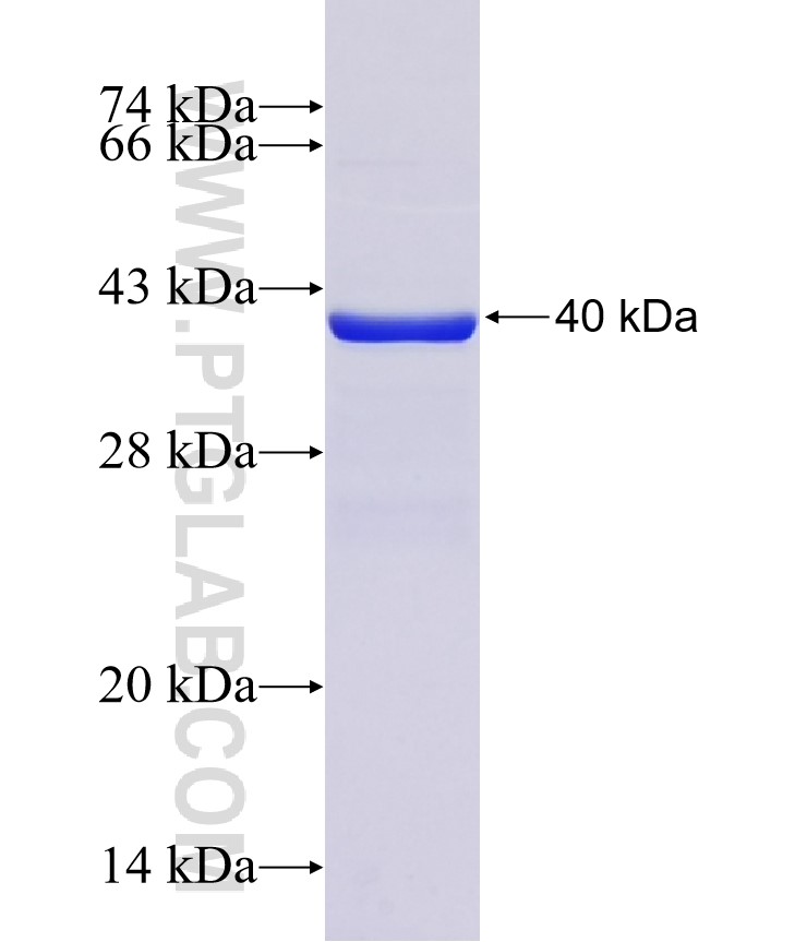 B4GALT5 fusion protein Ag37030 SDS-PAGE