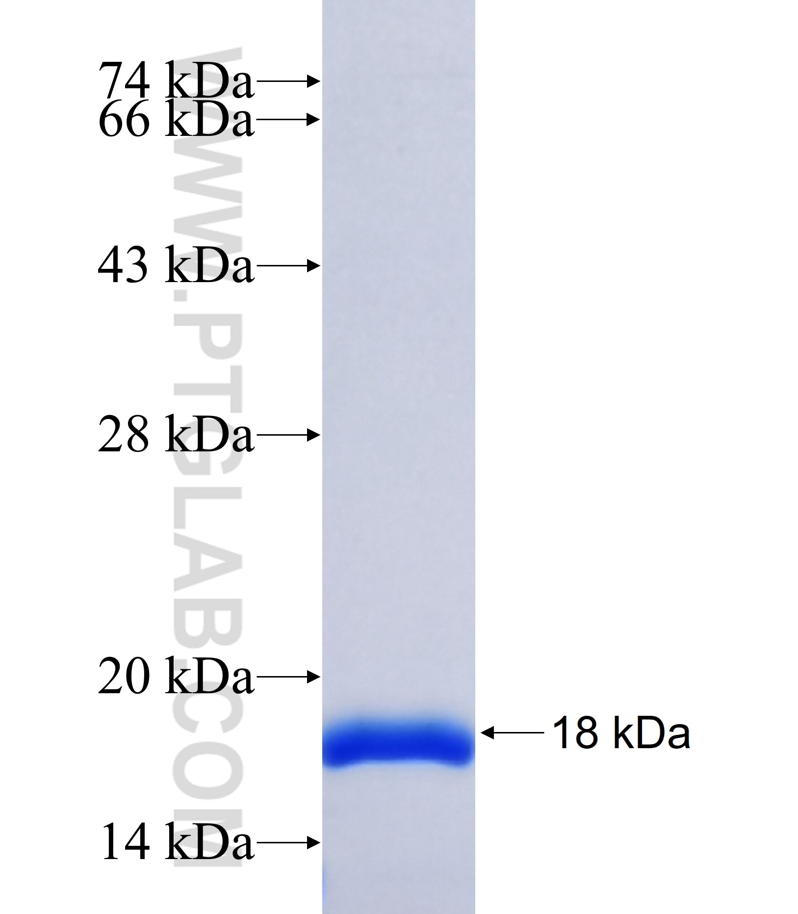 B4GALT5 fusion protein Ag37062 SDS-PAGE B4GALT5 fusion protein Ag37062 SDS-PAGE