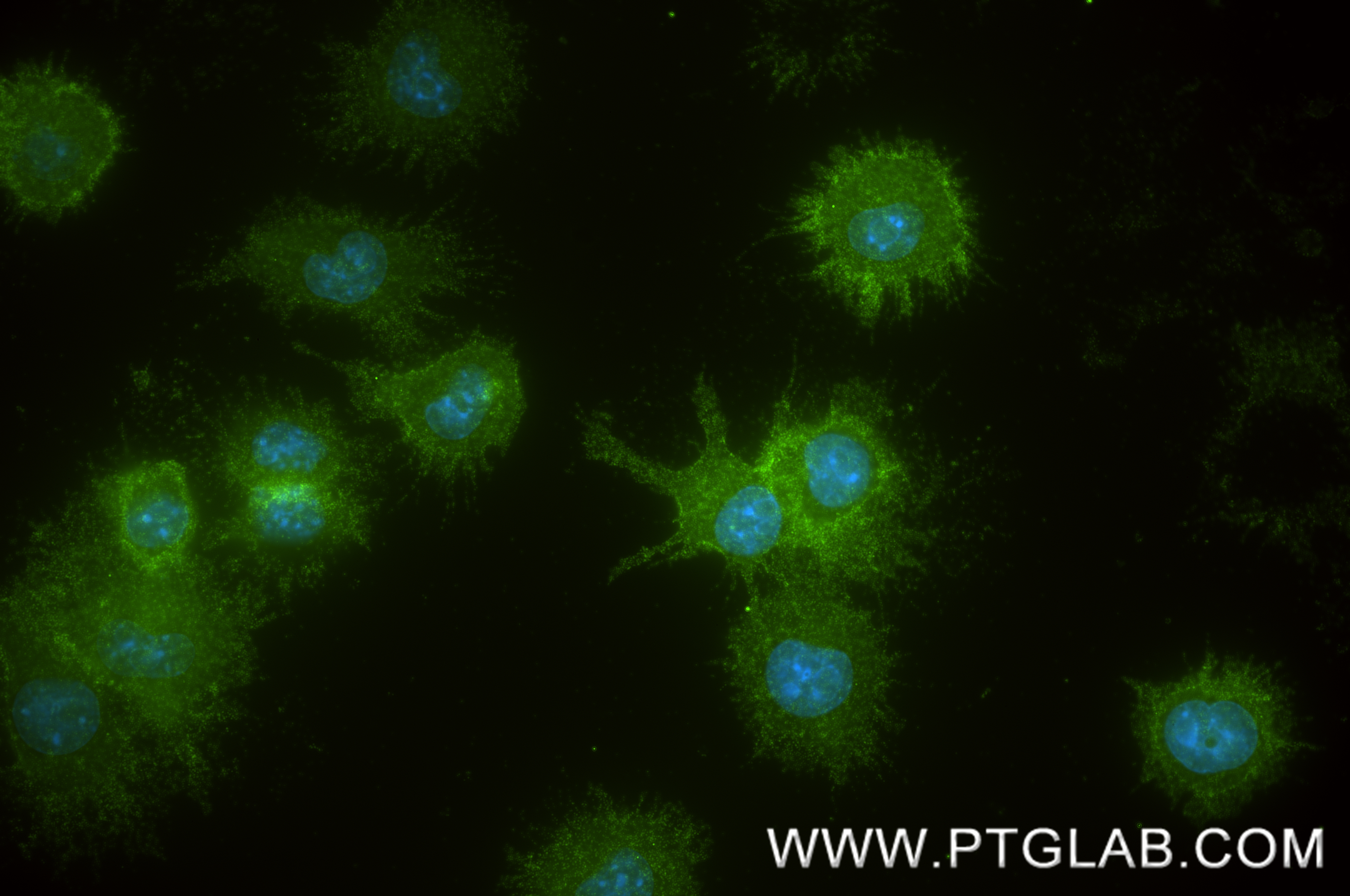 IF Staining of DC2.4 using 83213-10-RR IF Staining of DC2.4 using 83213-10-RR