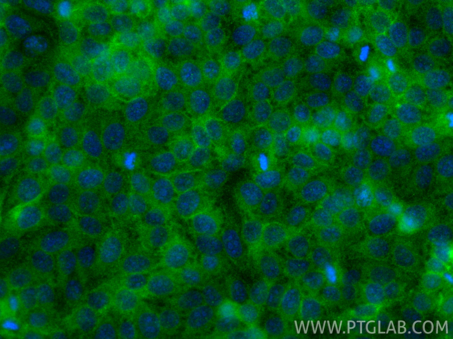IF Staining of HepG2 using 31620-1-AP