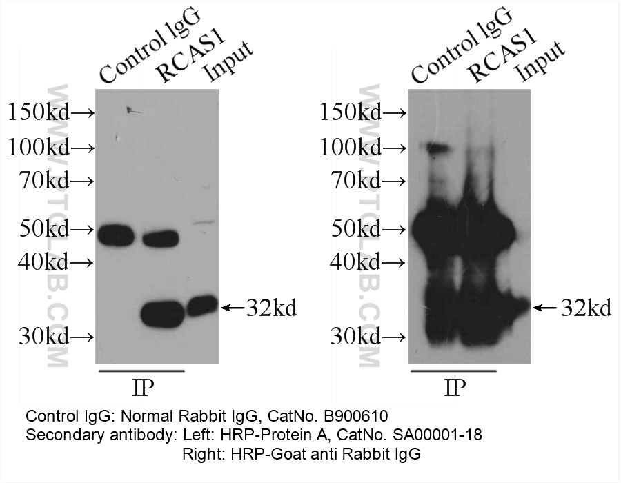 IP sample detected with different secondary antibodies. Normal Rabbit IgG (B900610) as control.