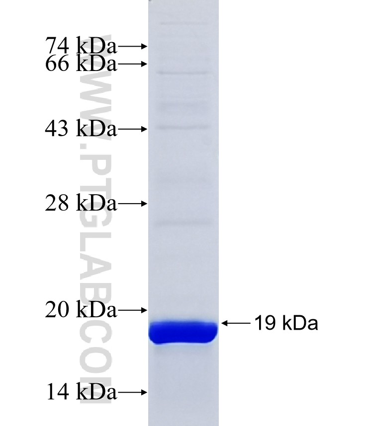 B9D1 fusion protein Ag38285 SDS-PAGE B9D1 fusion protein Ag38285 SDS-PAGE