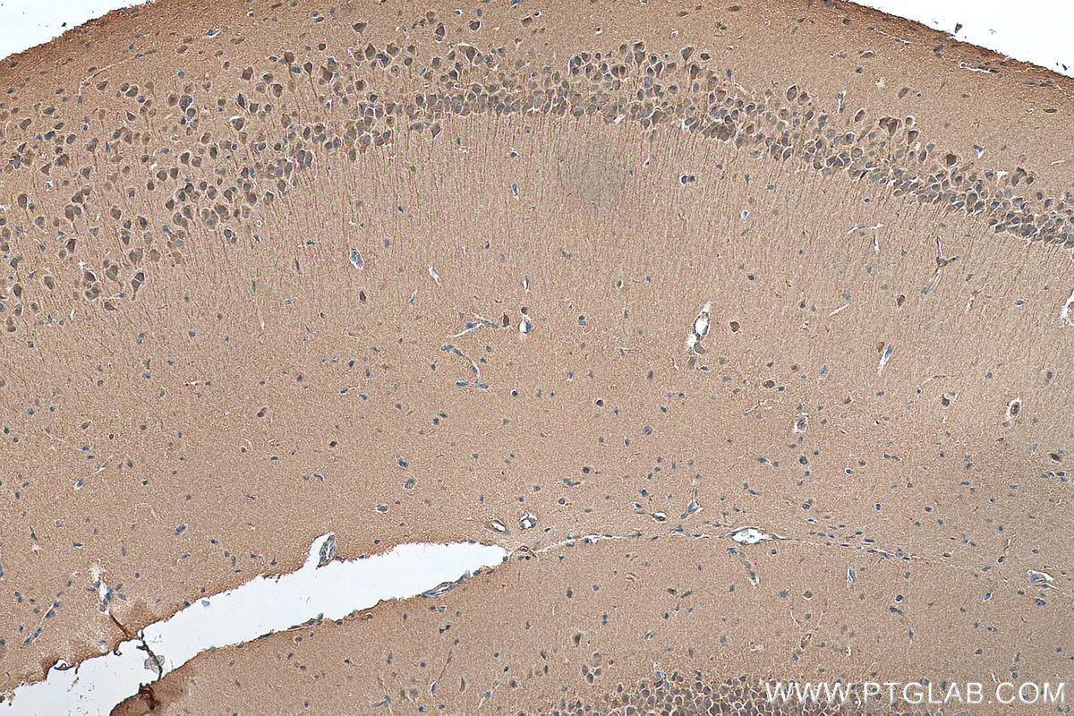 IHC staining of mouse brain using 24997-1-AP