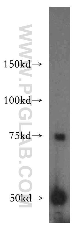 WB analysis of human liver using 15990-1-AP