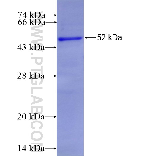 BAAT fusion protein Ag8849 SDS-PAGE