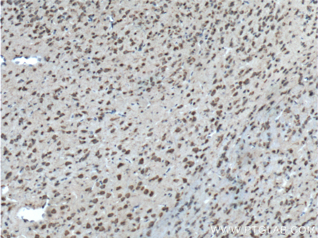IHC staining of mouse brain using 12807-1-AP