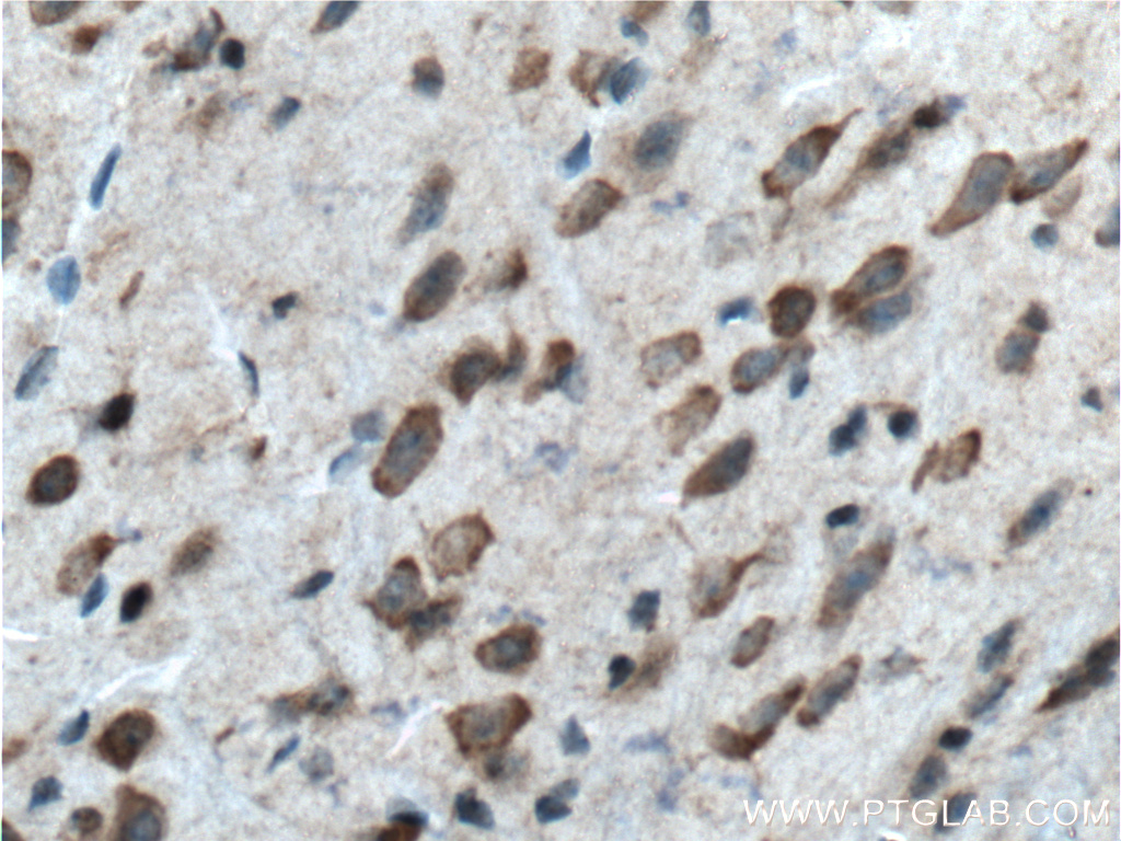 IHC staining of mouse brain using 12807-1-AP