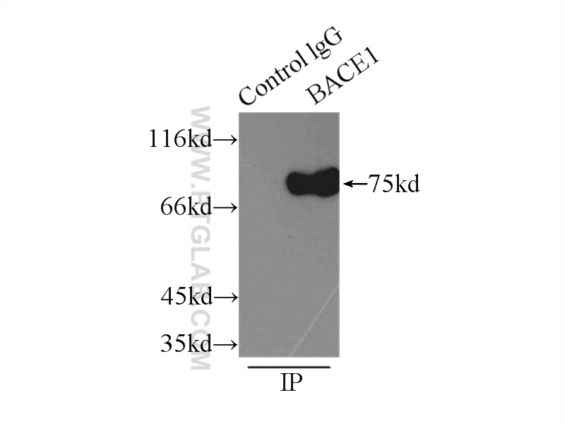 IP experiment of mouse brain using 12807-1-AP