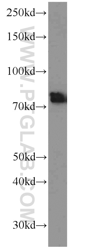 WB analysis of mouse brain using 12807-1-AP