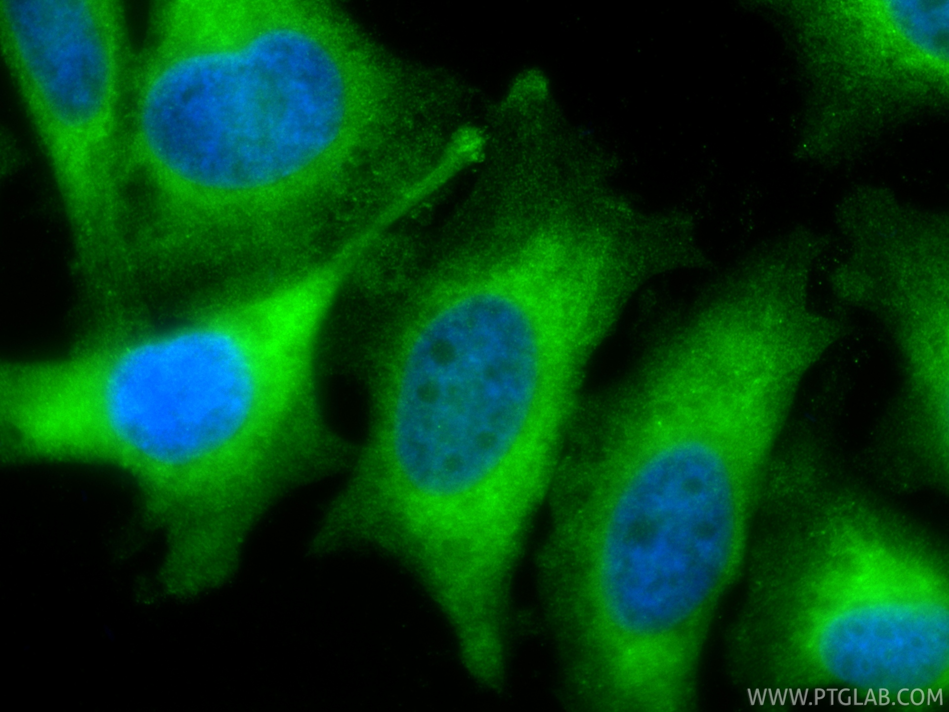 IF Staining of HeLa using 10435-1-AP IF Staining of HeLa using 10435-1-AP