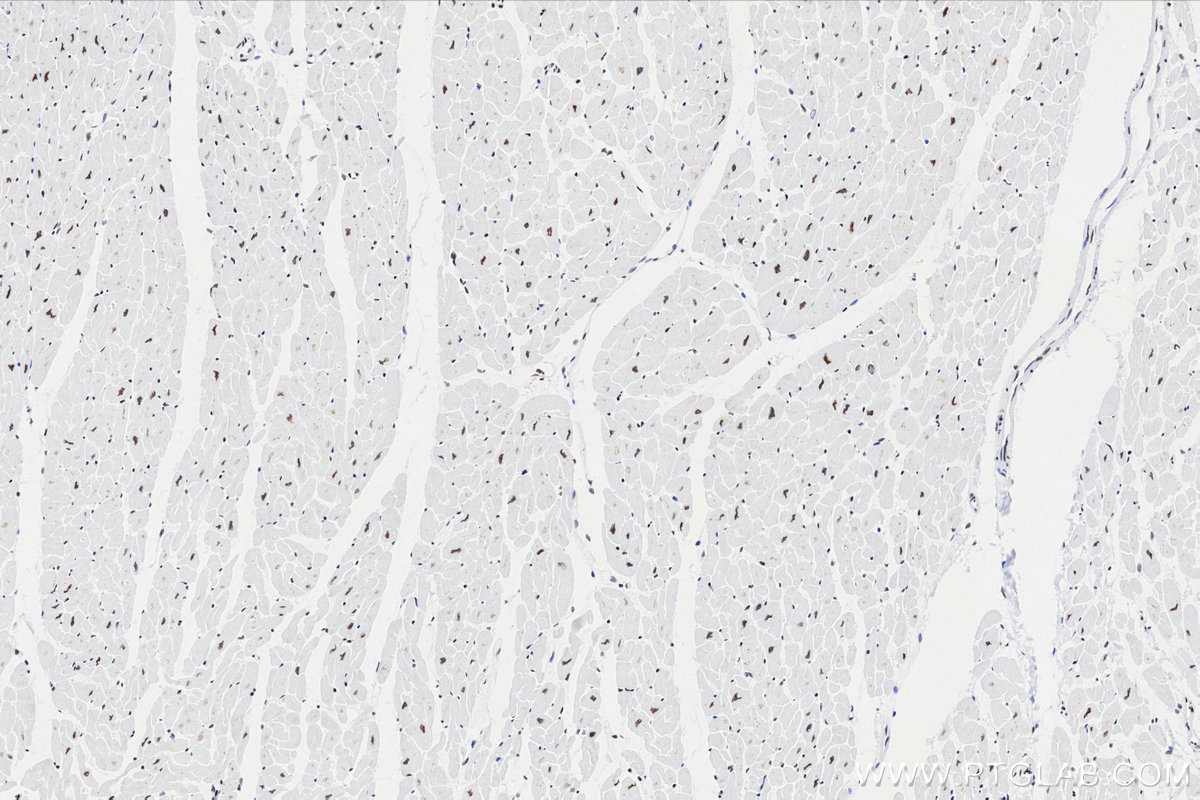 IHC staining of human heart using 86473-3-RR