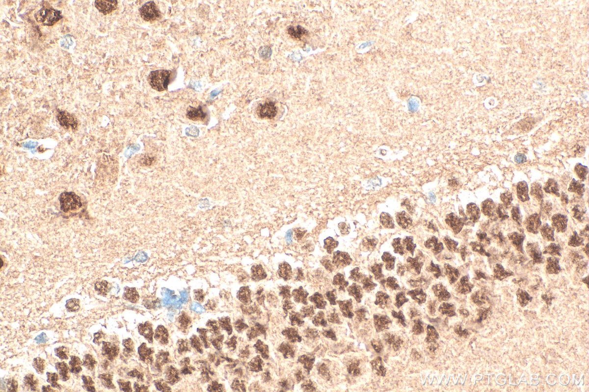 Immunohistochemical analysis of paraffin-embedded rat brain tissue slide using 27215-1-AP (BAF53B antibody) at dilution of 1:200 (under 40x lens). Heat mediated antigen retrieval with Tris-EDTA buffer (pH 9.0). IHC staining of rat brain using 27215-1-AP