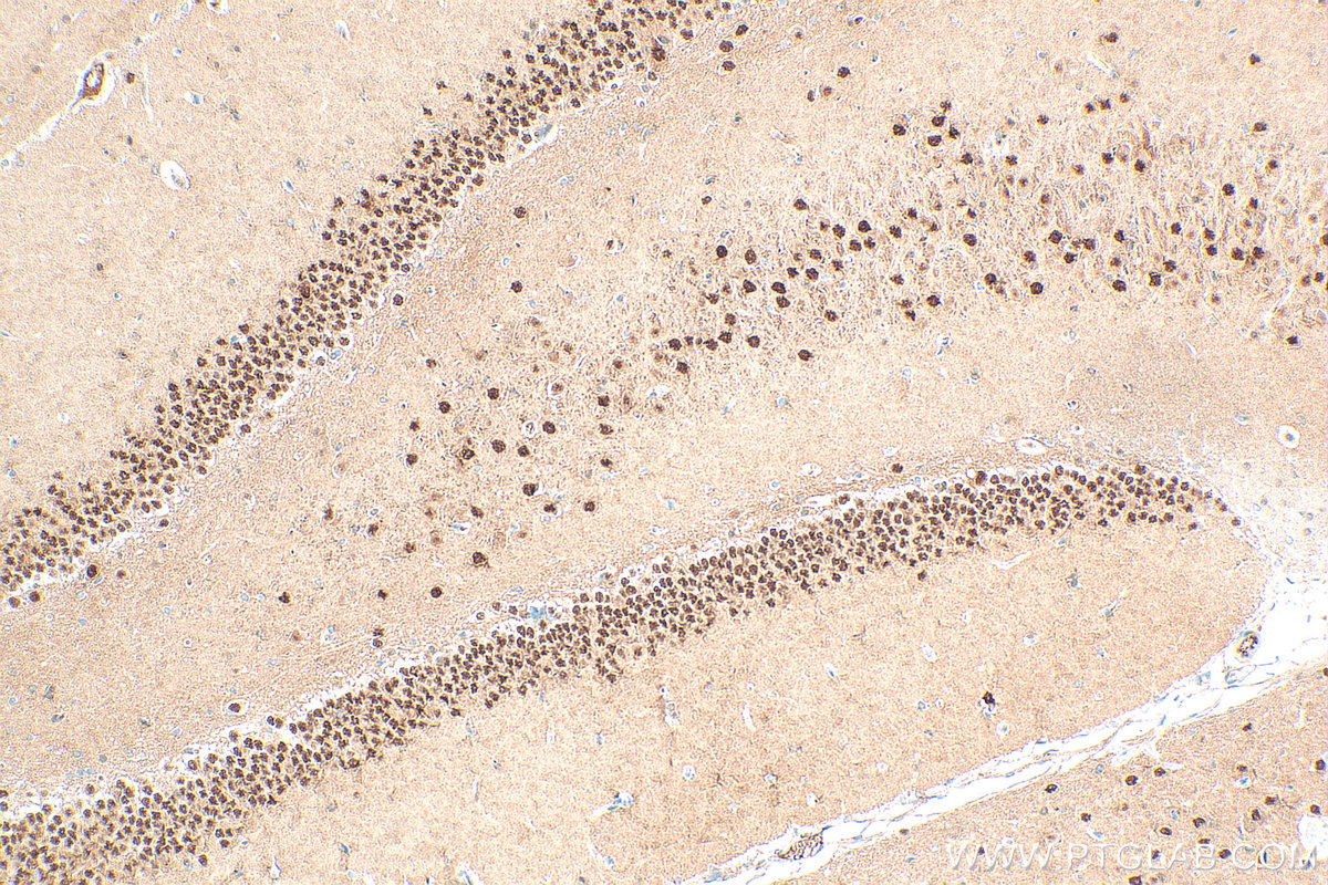 Immunohistochemical analysis of paraffin-embedded rat brain tissue slide using 27215-1-AP (BAF53B antibody) at dilution of 1:200 (under 10x lens). Heat mediated antigen retrieval with Tris-EDTA buffer (pH 9.0). IHC staining of rat brain using 27215-1-AP