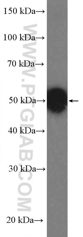 WB analysis of mouse brain using 27215-1-AP