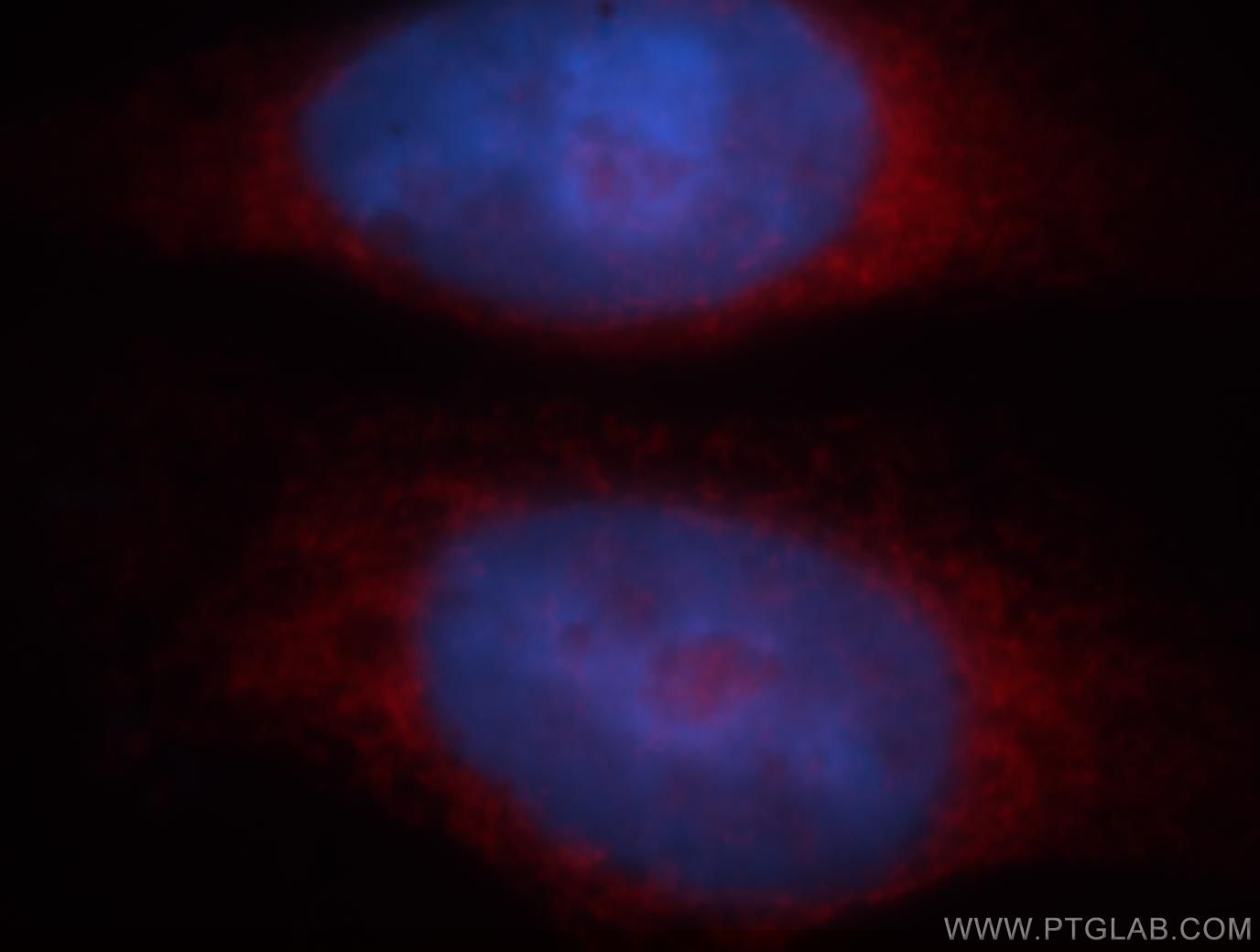 IF Staining of HeLa using 19064-1-AP