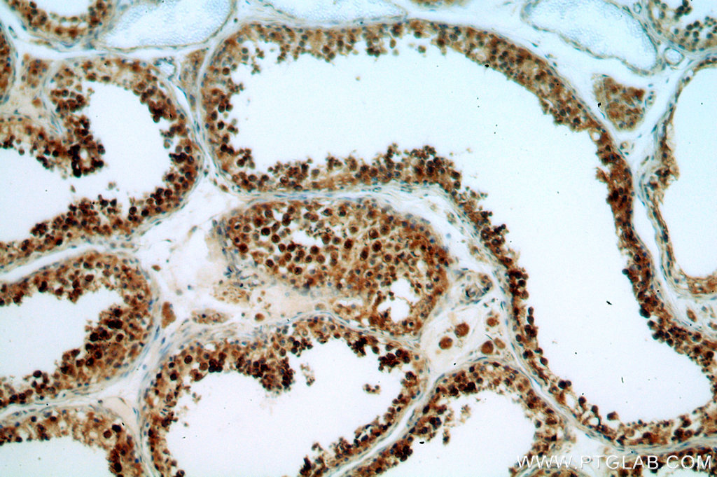 IHC staining of human testis using 19064-1-AP