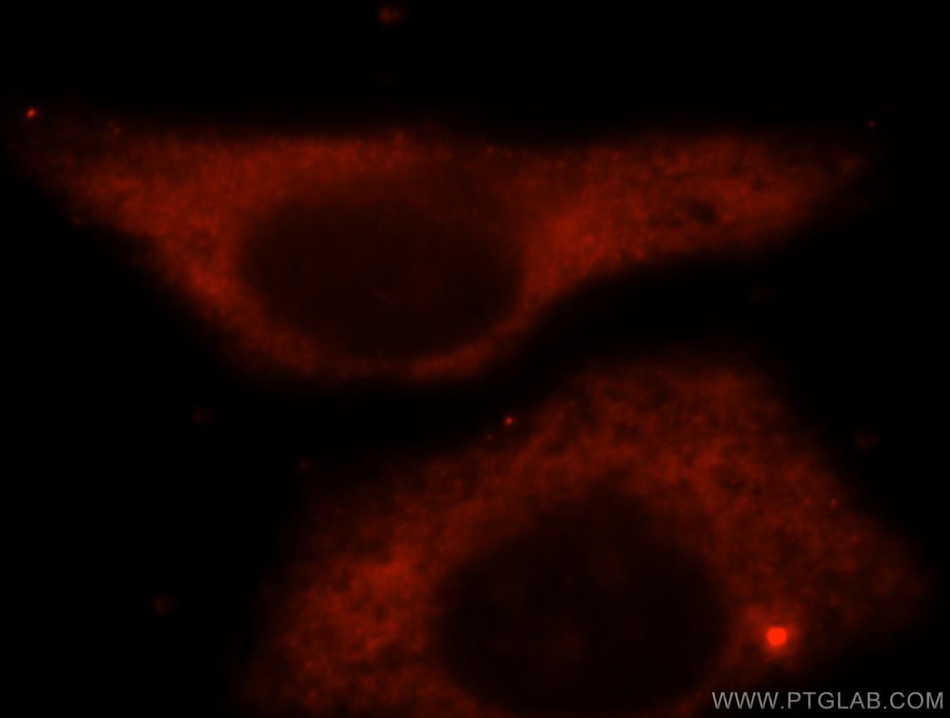 IF Staining of HepG2 using 16148-1-AP (same clone as 16148-1-PBS)