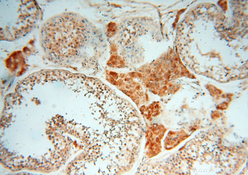 IHC staining of human testis using 16150-1-AP