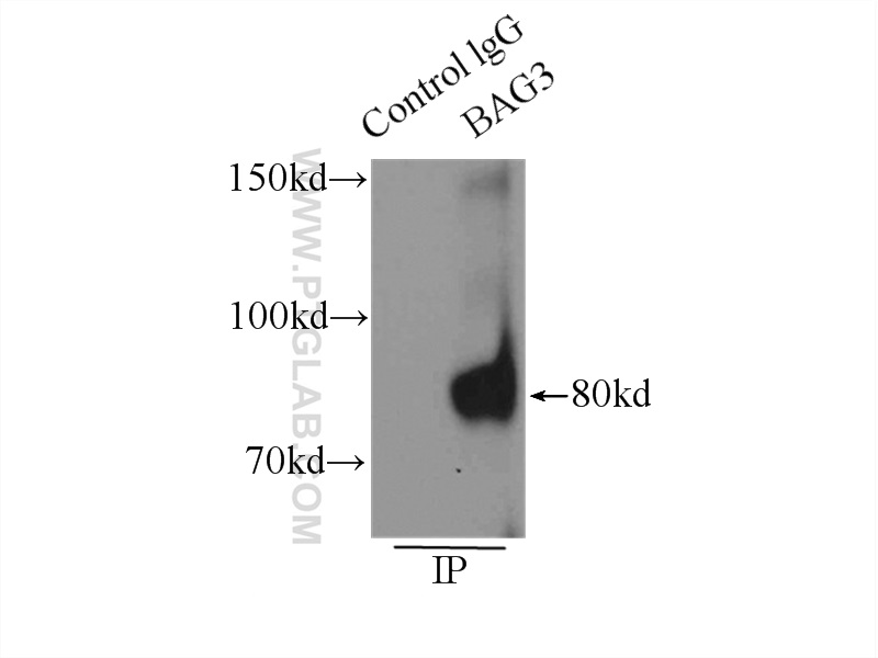 IP experiment of K-562 using 10599-1-AP