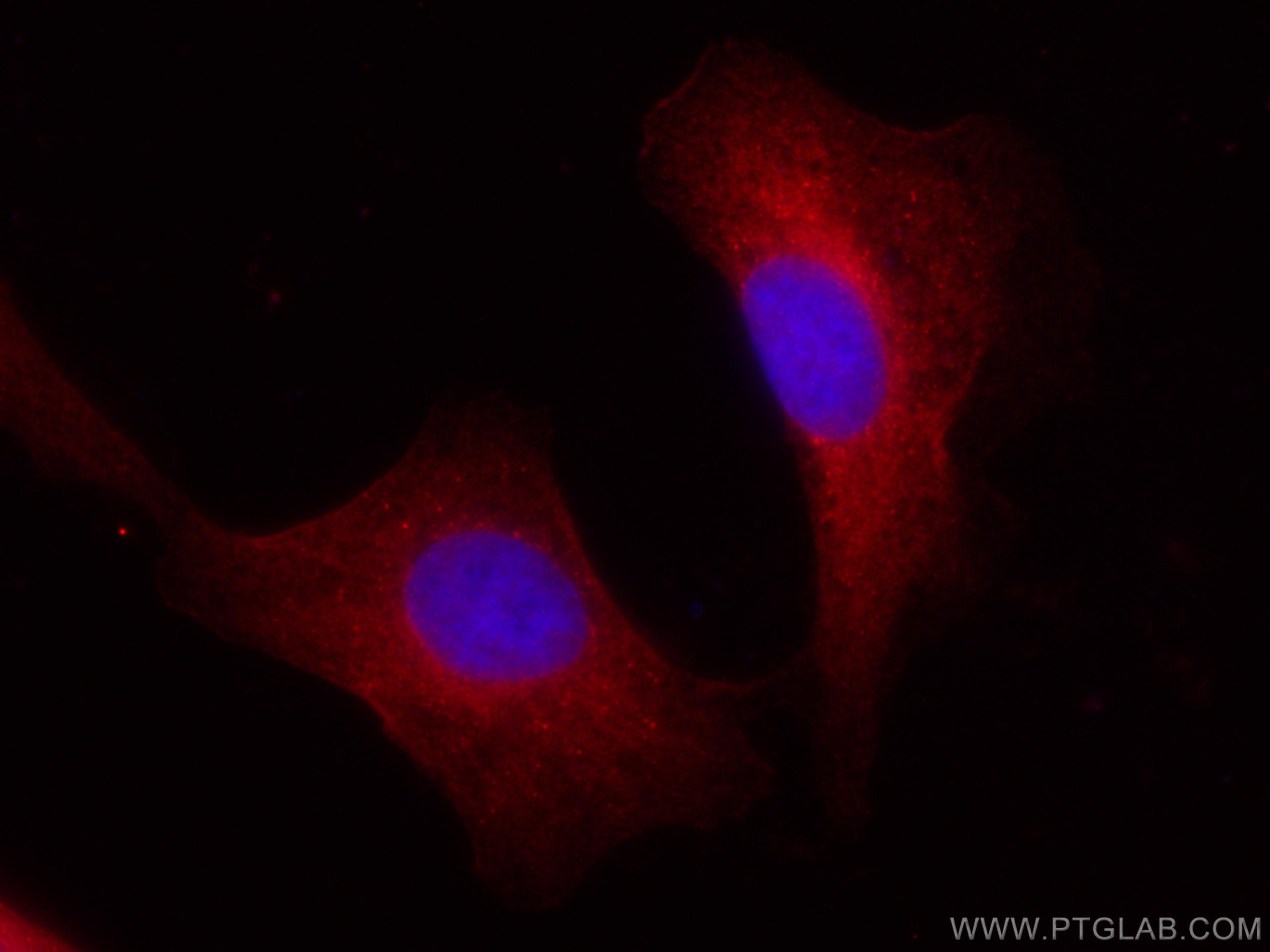 IF Staining of A549 using CL594-10599