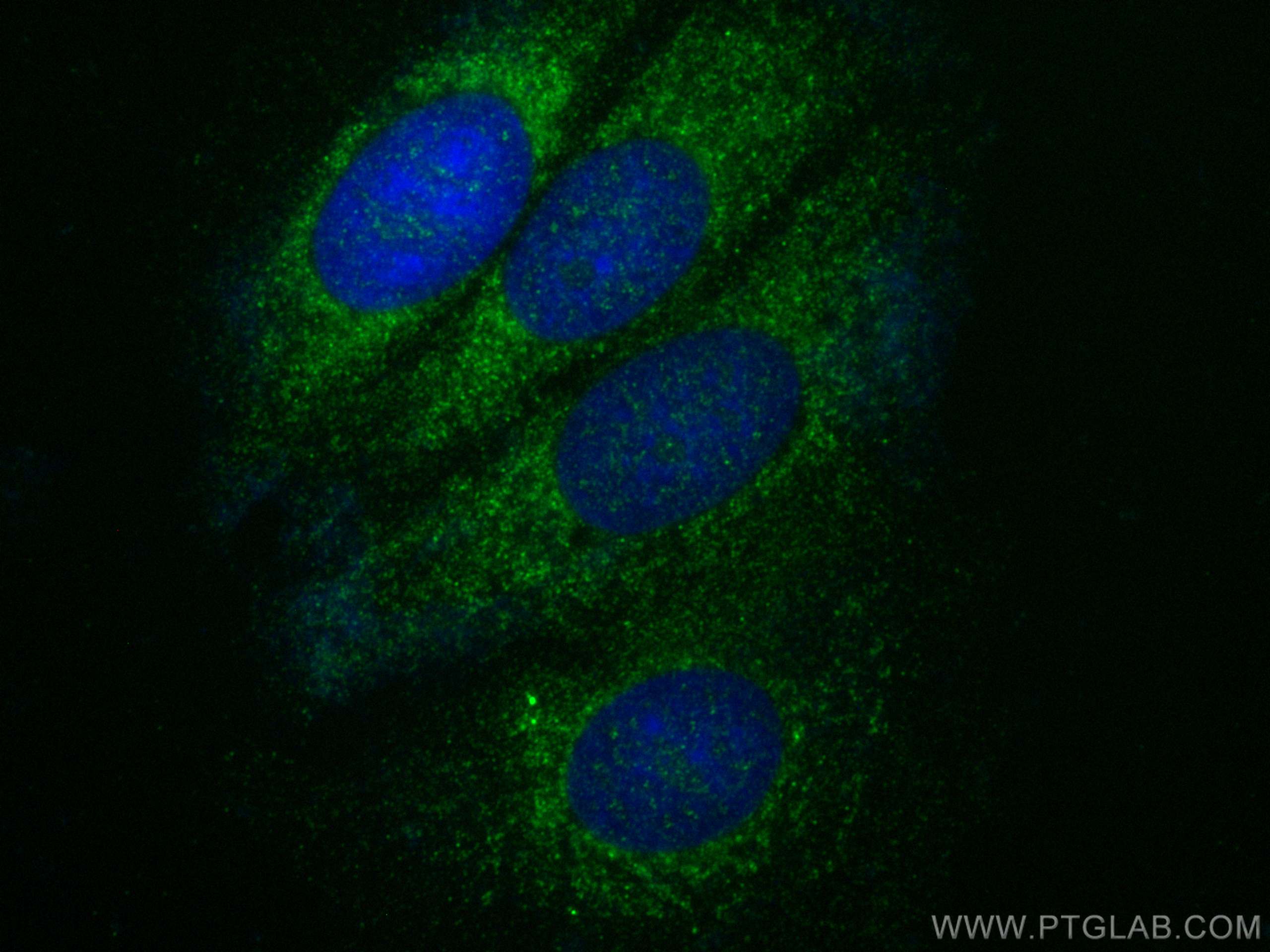 IF Staining of MCF-7 using 13913-1-AP