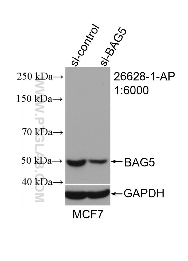 WB analysis of MCF-7 using 26628-1-AP