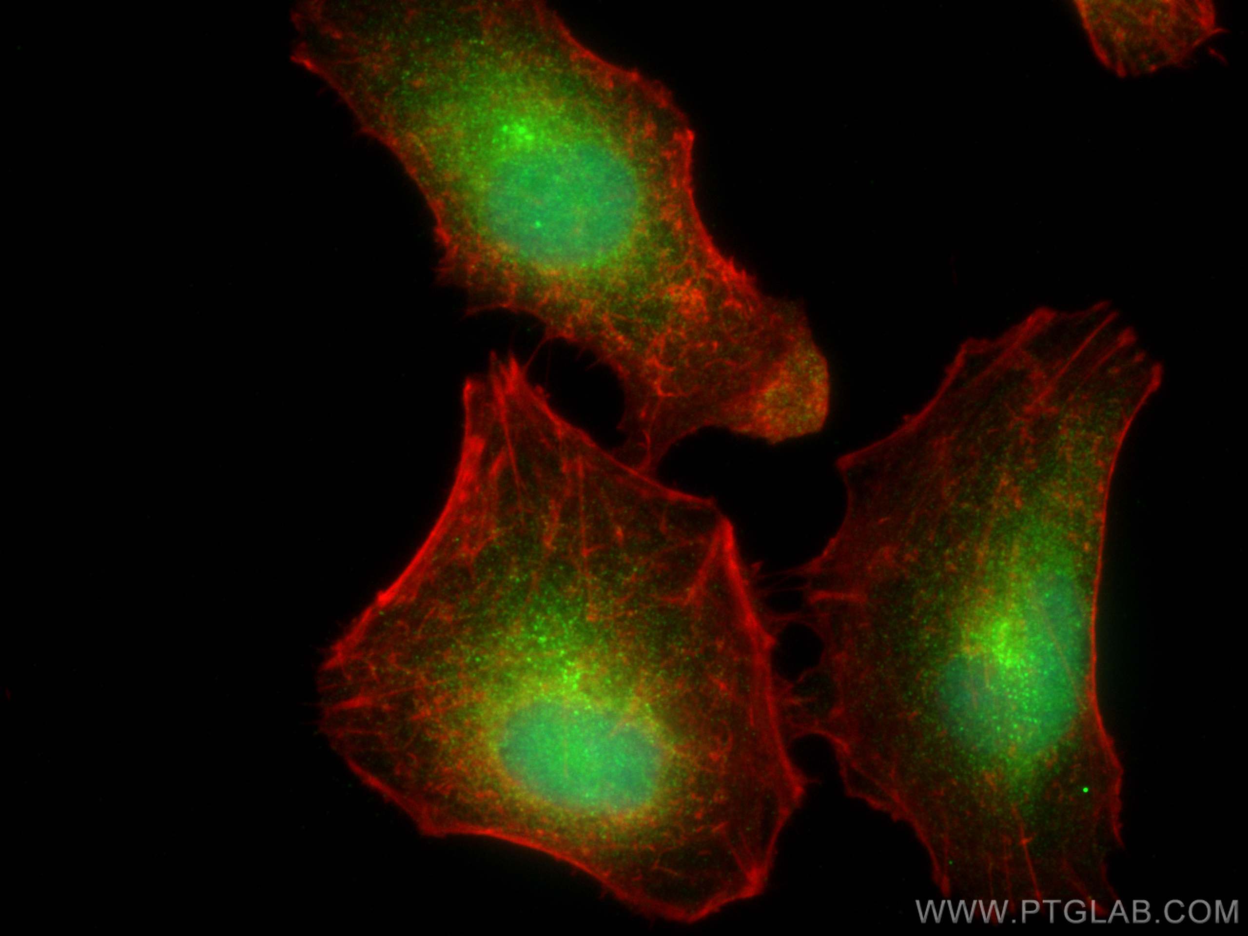 IF Staining of A549 using 30046-1-AP