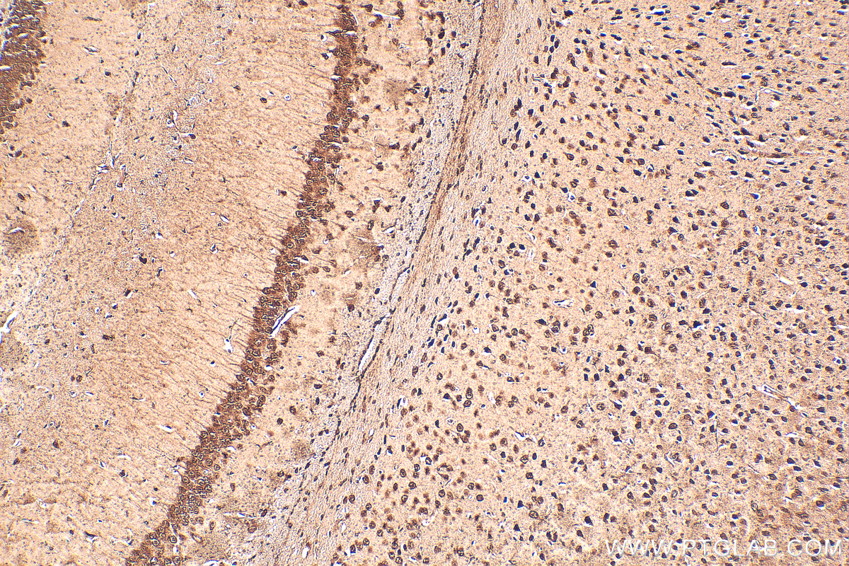 IHC staining of mouse brain using 30046-1-AP