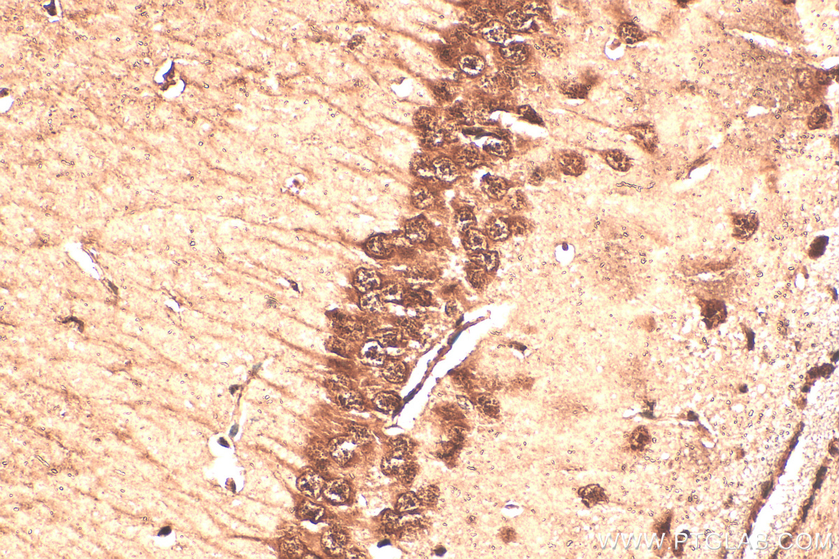 IHC staining of mouse brain using 30046-1-AP
