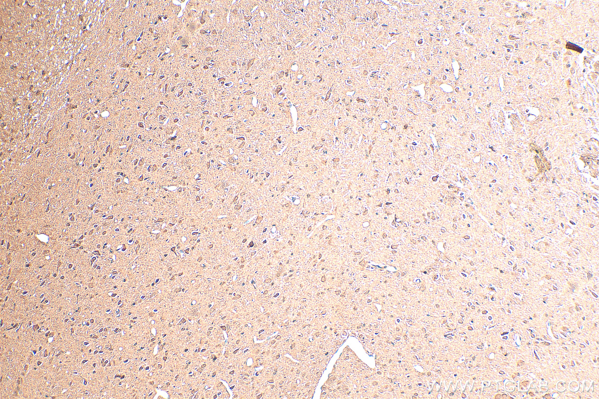 IHC staining of rat brain using 30046-1-AP