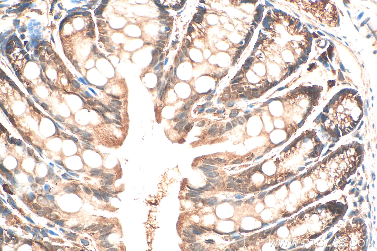 IHC staining of mouse colon using 30046-1-AP