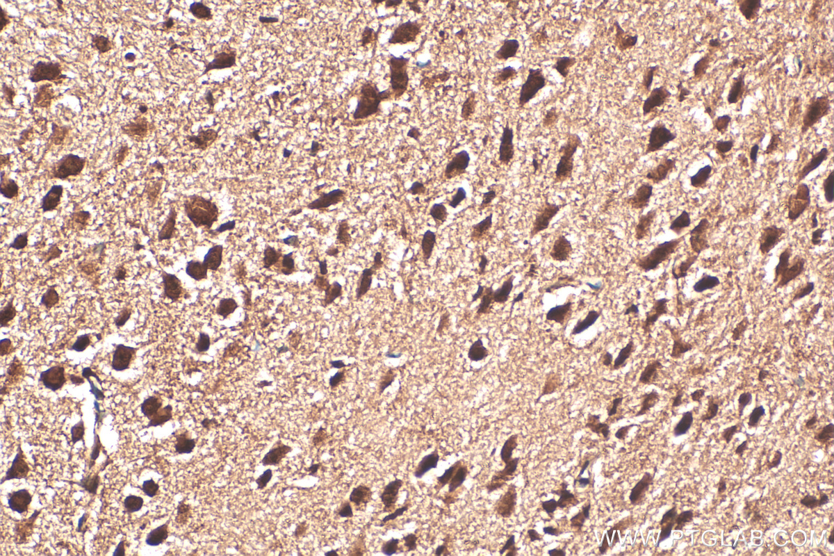 IHC staining of mouse brain using 30046-1-AP