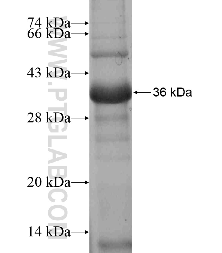 BAI3 fusion protein Ag17399 SDS-PAGE BAI3 fusion protein Ag17399 SDS-PAGE
