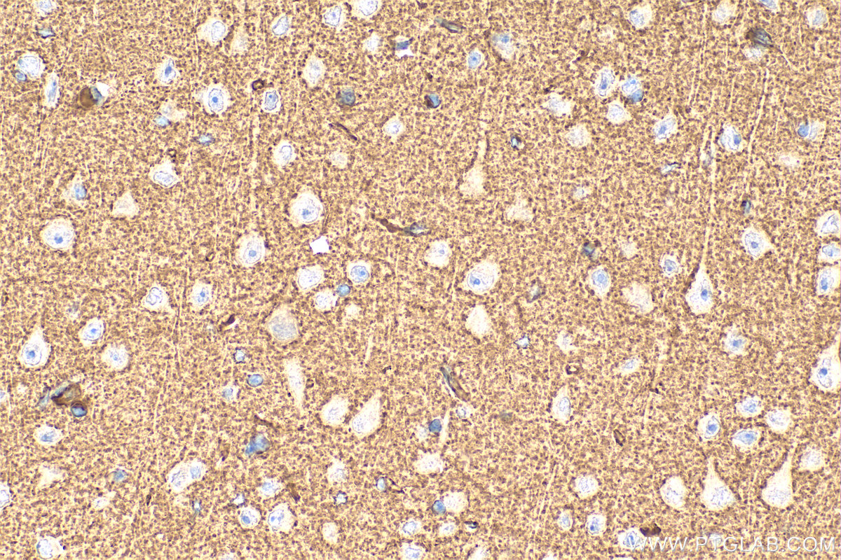 IHC staining of mouse brain using 19789-1-AP