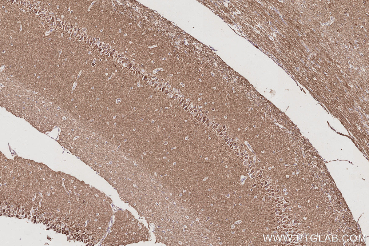 IHC staining of rat brain using 11087-2-AP IHC staining of rat brain using 11087-2-AP